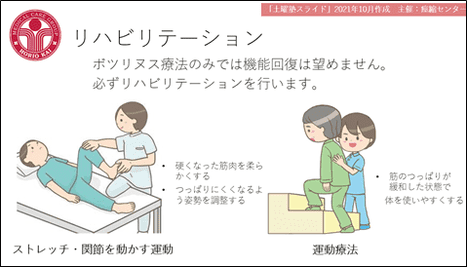 リハビリテーションの説明図。理学療法士が横になった患者のストレッチと関節を動かす運動を行う場面と、患者が段差を昇る運動療法の場面